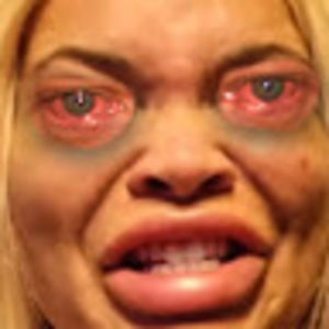 Meet your Posher, Burntpotato